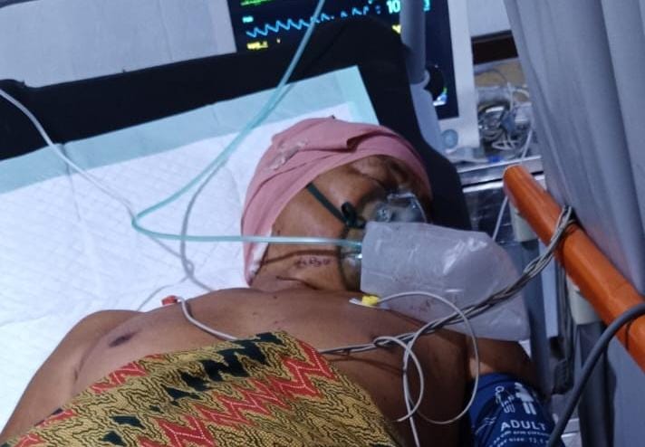 Dikeroyok 6 Orang Darmawi Luka Parah Hingga Koma di RS Muhammad Hoesin Palembang