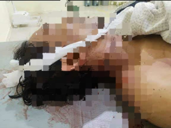 Ribut di Kafe, Pria Meninggal Akibat Luka Sobek di Leher