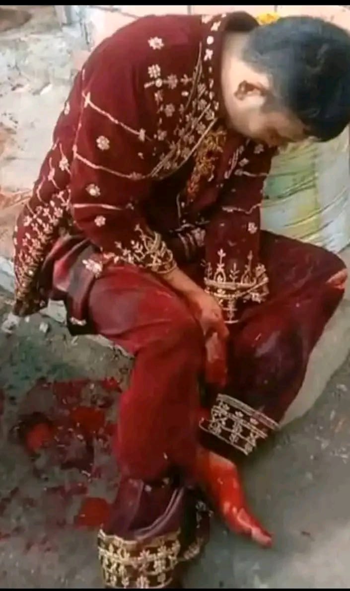 Akibat Dendam Lama Pengatin Laki Laki Di Palembang di Bacok Mau Akad Nikah